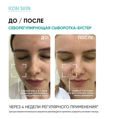 Себорегулирующая сыворотка-концентрат с ниацинамидом Rest Your Sebum, 30 мл