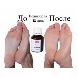 РЕМУВЕР BIOGEL, код 4238006